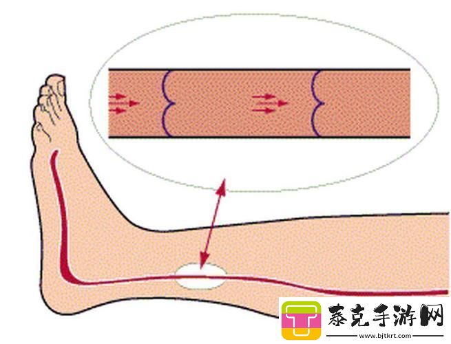 科技狂潮里的美腿秘籍：静脉里的创新舞者！
