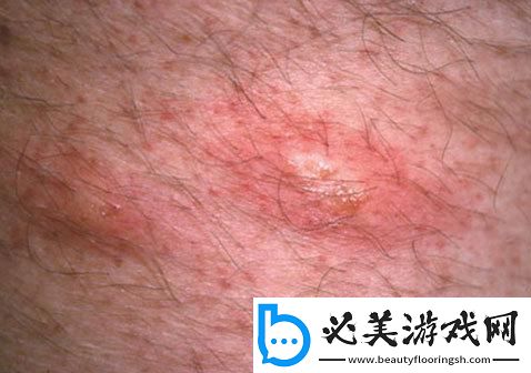 “两个蛋蛋”之谜：疙瘩里的科技新话题！